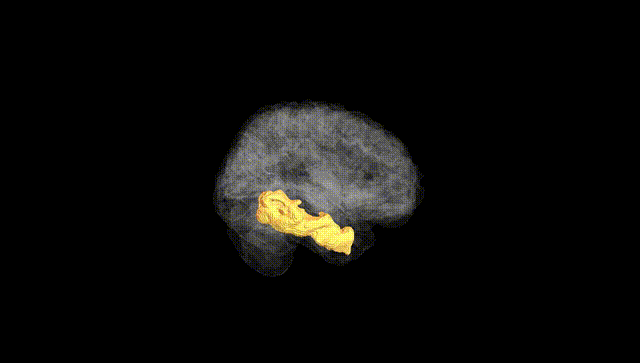 Full Brain Black