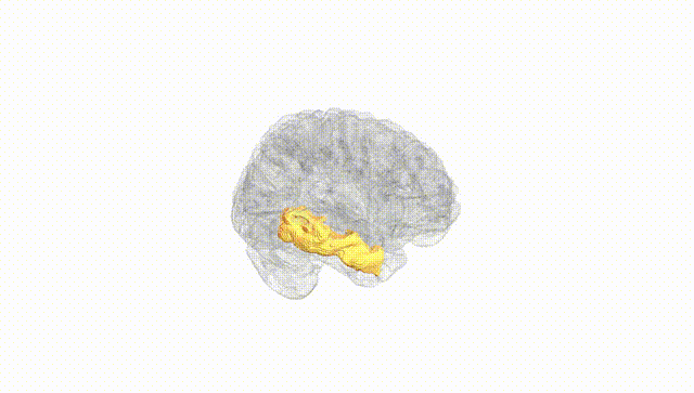 Full Brain White