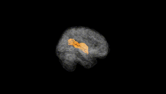 Full Brain Black