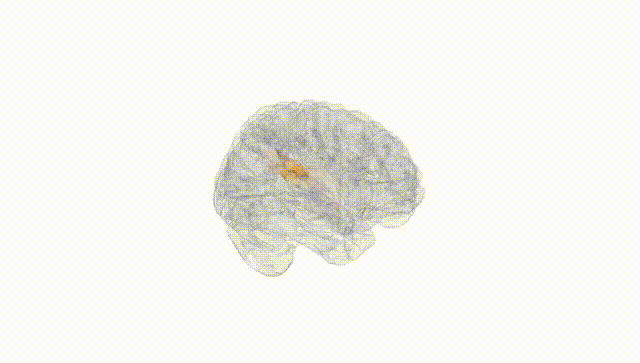 Full Brain White
