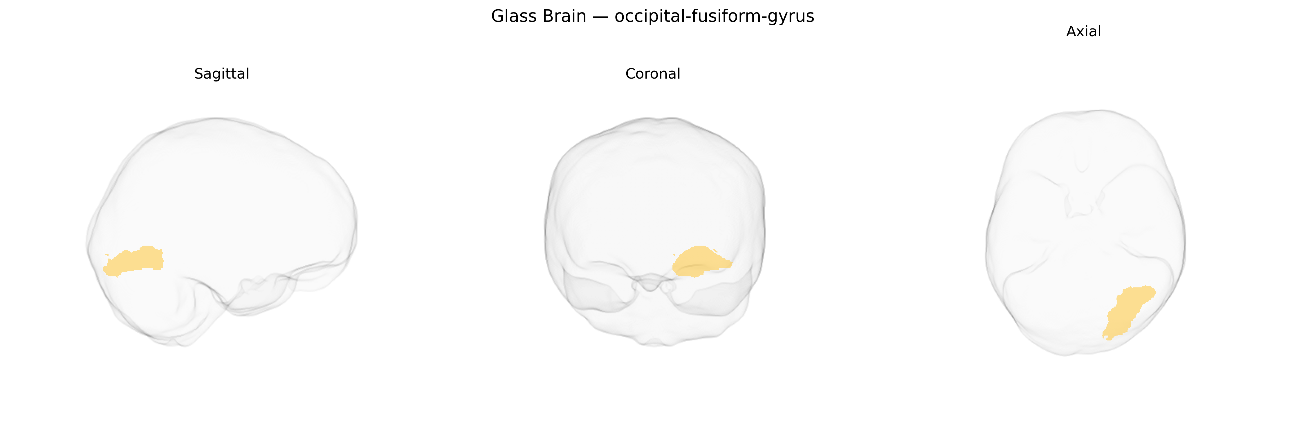 Triplanar Ghost Brain
