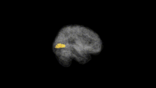 Full Brain Black