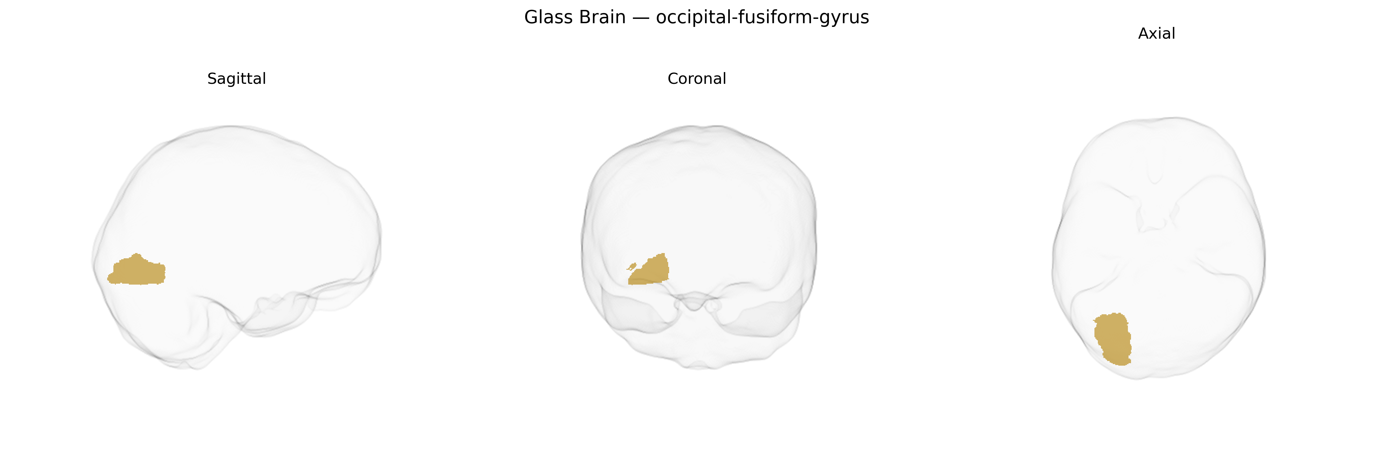 Triplanar Ghost Brain