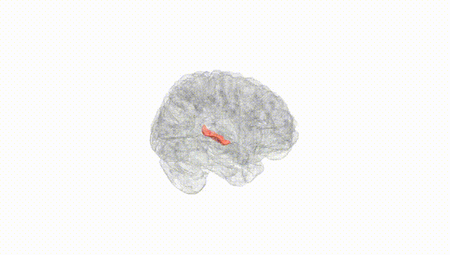 Full Brain White