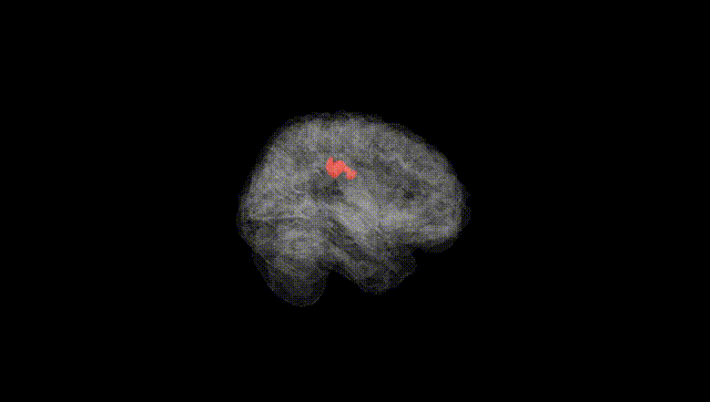 Full Brain Black