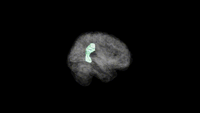 Full Brain Black