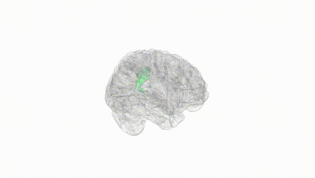 Full Brain White