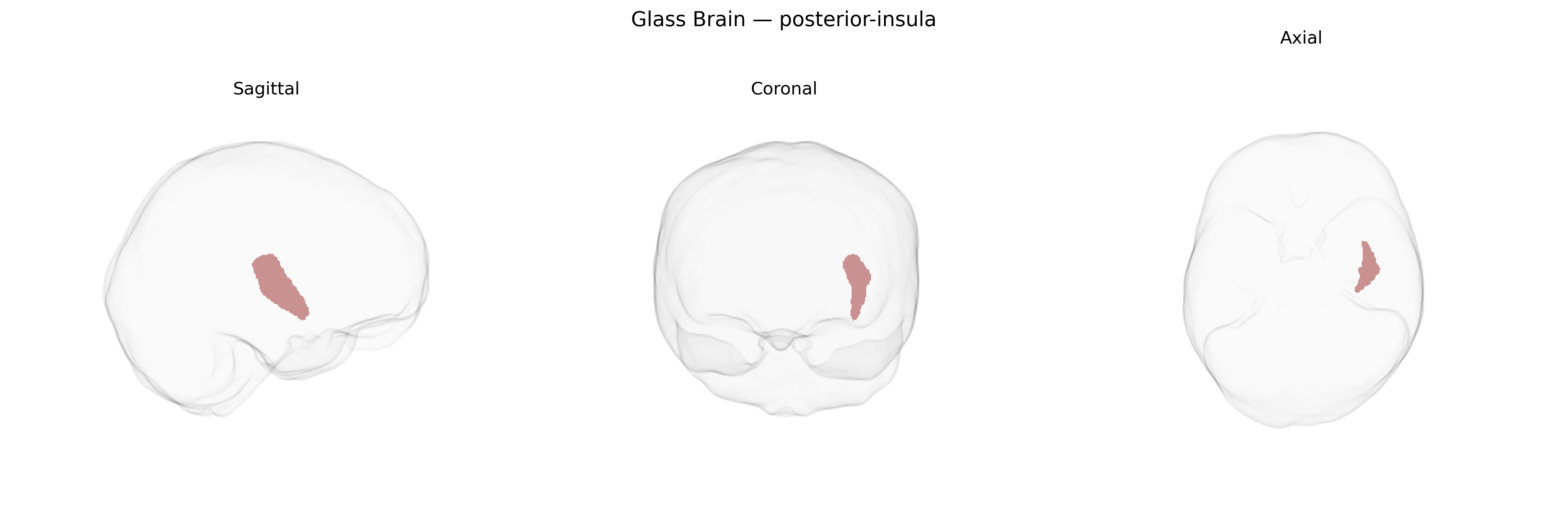 Triplanar Ghost Brain