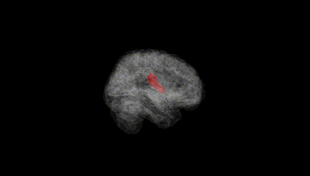 Full Brain Black
