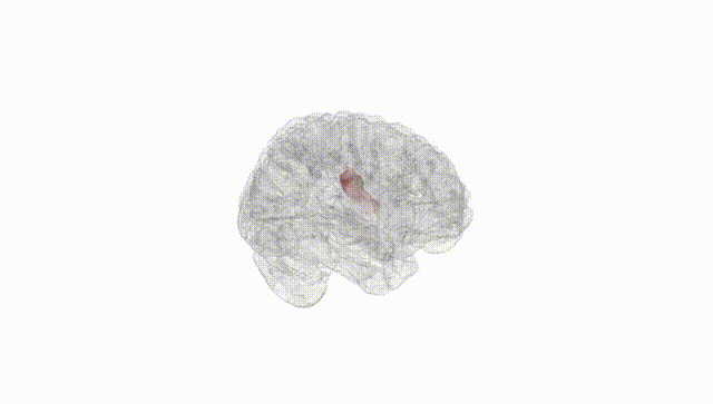 Full Brain White