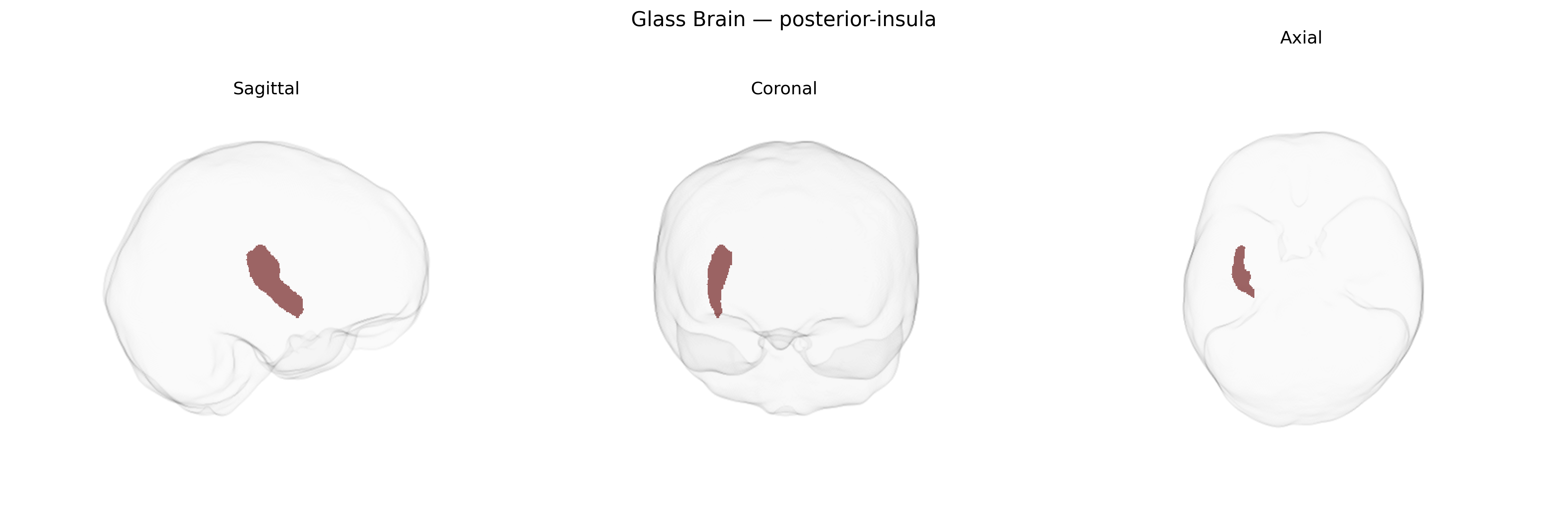 Triplanar Ghost Brain