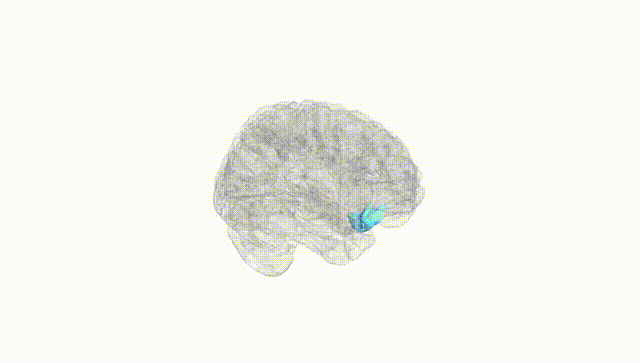 Full Brain White