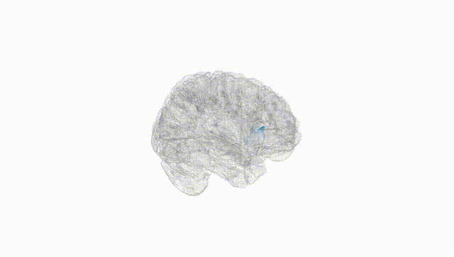 Full Brain White
