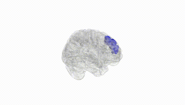 Full Brain White