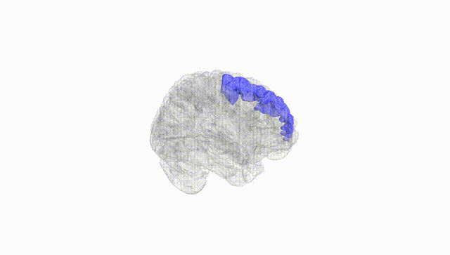 Full Brain White