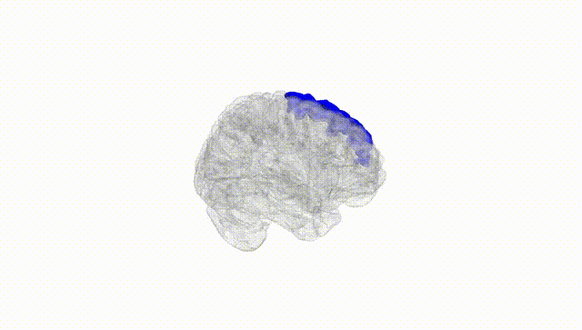 Full Brain White