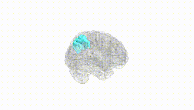 Full Brain White