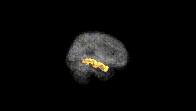 Full Brain Black