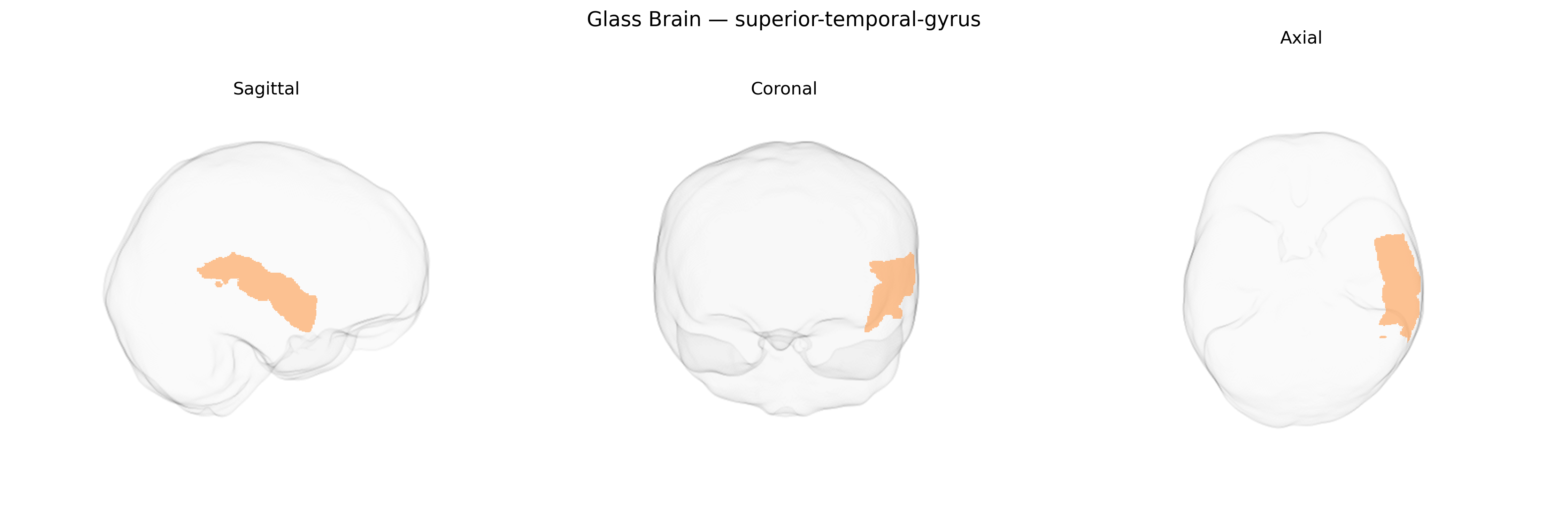 Triplanar Ghost Brain