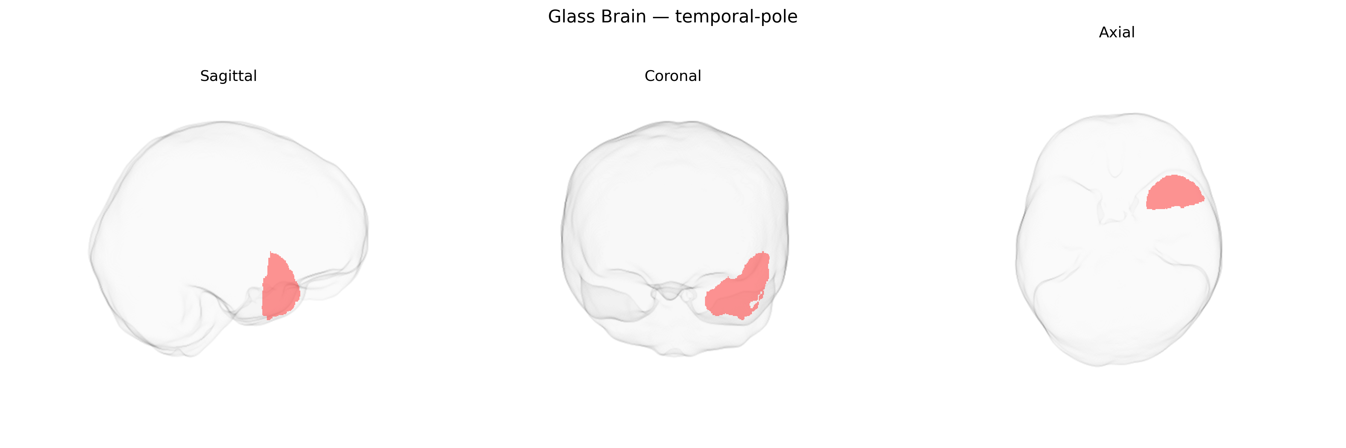 Triplanar Ghost Brain