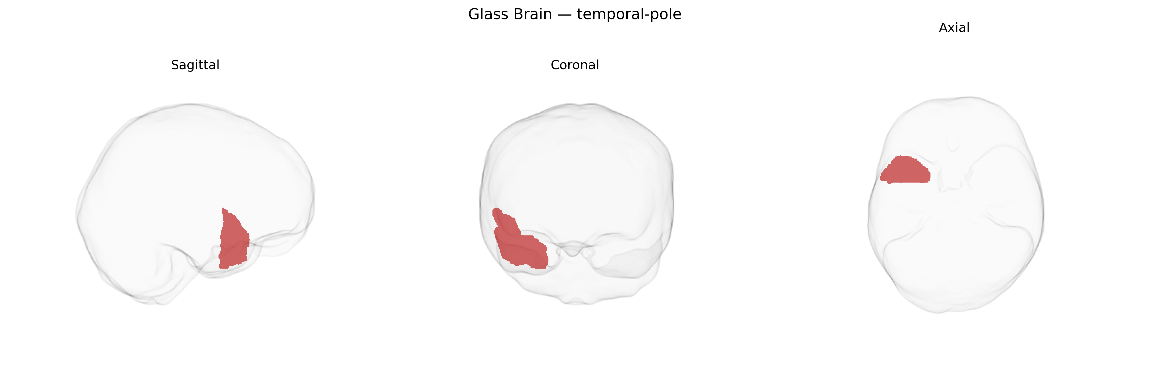 Triplanar Ghost Brain