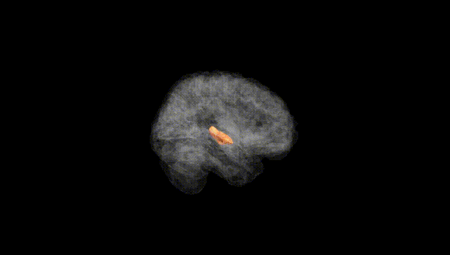 Full Brain Black