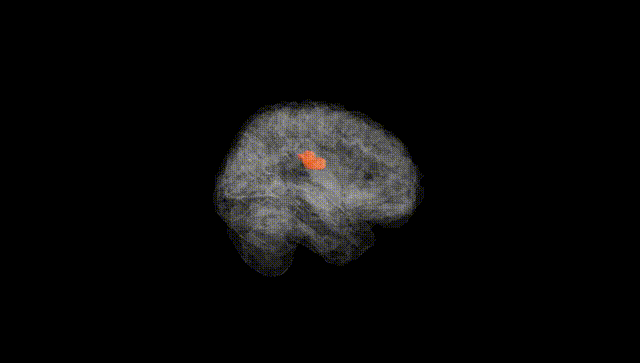 Full Brain Black